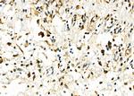 UCP2 Antibody in Immunohistochemistry (Paraffin) (IHC (P))