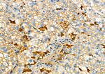 ATP6V0D1 Antibody in Immunohistochemistry (Paraffin) (IHC (P))