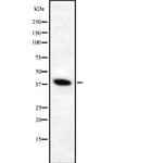 ATP6V0D1 Antibody in Western Blot (WB)