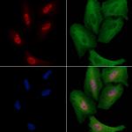 Cdc23 Antibody in Immunocytochemistry (ICC/IF)