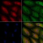 HSD17B11 Antibody in Immunocytochemistry (ICC/IF)