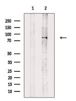 GIT1 Antibody in Western Blot (WB)