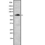 MDM1 Antibody in Western Blot (WB)