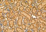 NOX1 Antibody in Immunohistochemistry (Paraffin) (IHC (P))