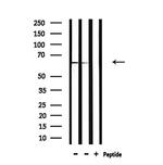 NOX1 Antibody in Western Blot (WB)