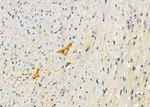 PIKFYVE Antibody in Immunohistochemistry (Paraffin) (IHC (P))