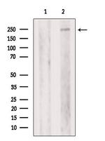 PIKFYVE Antibody in Western Blot (WB)