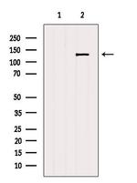 POM121 Antibody in Western Blot (WB)