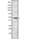 SOX8/SOX9/SOX17/SOX18 Antibody in Western Blot (WB)