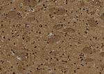 TBX15/TBX18 Antibody in Immunohistochemistry (Paraffin) (IHC (P))