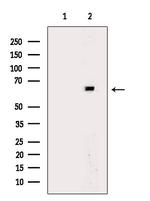 TBX15/TBX18 Antibody in Western Blot (WB)