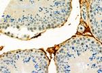 p53DINP1 Antibody in Immunohistochemistry (Paraffin) (IHC (P))