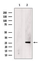 p53DINP1 Antibody in Western Blot (WB)