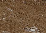 Phospho-CK1 alpha (Tyr294) Antibody in Immunohistochemistry (Paraffin) (IHC (P))