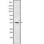 Phospho-CK1 alpha (Tyr294) Antibody in Western Blot (WB)