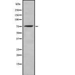 Phospho-ICK (Tyr159) Antibody in Western Blot (WB)