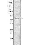 Phospho-OXSR1 (Thr185) Antibody in Western Blot (WB)