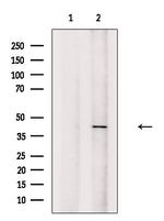 HOXA2 Antibody in Western Blot (WB)