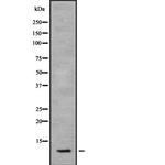 SNAPC5 Antibody in Western Blot (WB)