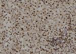 ZIC Pan Antibody in Immunohistochemistry (Paraffin) (IHC (P))