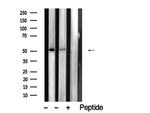 ZIC Pan Antibody in Western Blot (WB)