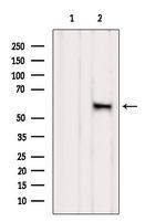 Herpes Simplex Virus Type 1 (strain 17) Antibody in Western Blot (WB)