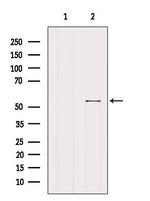 Herpes Simplex Virus Type 1 (strain 17) Antibody in Western Blot (WB)