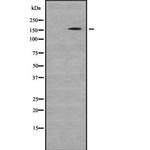 GLI3 Antibody in Western Blot (WB)