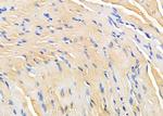 PPP2R1A Antibody in Immunohistochemistry (Paraffin) (IHC (P))