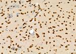 GTF2A2 Antibody in Immunohistochemistry (Paraffin) (IHC (P))