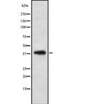 GTF2A2 Antibody in Western Blot (WB)