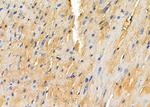 SNRPD3 Antibody in Immunohistochemistry (Paraffin) (IHC (P))