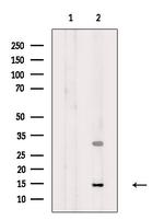 SNRPD3 Antibody in Western Blot (WB)