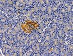 MRPS11 Antibody in Immunohistochemistry (Paraffin) (IHC (P))