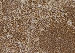 CSB Antibody in Immunohistochemistry (Paraffin) (IHC (P))