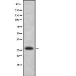 EMX2 Antibody in Western Blot (WB)