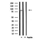 ZBTB17 Antibody in Western Blot (WB)