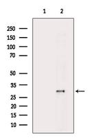 HNRNPA0 Antibody in Western Blot (WB)