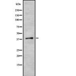 SRSF6 Antibody in Western Blot (WB)