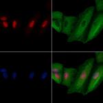 SART3 Antibody in Immunocytochemistry (ICC/IF)