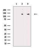 SART3 Antibody in Western Blot (WB)