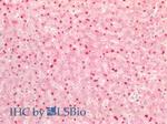 TTF1 Antibody in Immunohistochemistry (Paraffin) (IHC (P))