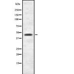 AGK Antibody in Western Blot (WB)