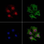 ZFPM2 Antibody in Immunocytochemistry (ICC/IF)