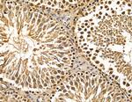 Ubinuclein 1 Antibody in Immunohistochemistry (Paraffin) (IHC (P))