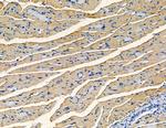 AKAP11 Antibody in Immunohistochemistry (Paraffin) (IHC (P))