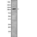 MKL2 Antibody in Western Blot (WB)