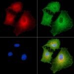 COL8A1 Antibody in Immunocytochemistry (ICC/IF)