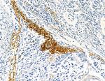 COL8A1 Antibody in Immunohistochemistry (Paraffin) (IHC (P))