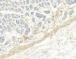 COL8A1 Antibody in Immunohistochemistry (Paraffin) (IHC (P))